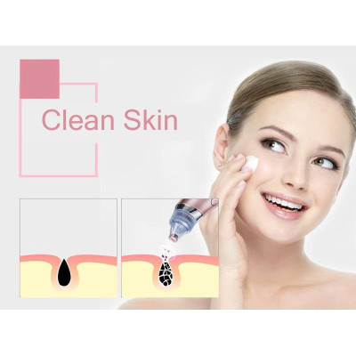 Вакуумный аппарат для чистки пор лица Menqshahayd XN-8030 Pink (kz048-hbr) Вакуумный аппарат для чистки пор лица Menqshahayd XN-8030 Pink (kz048-hbr)
