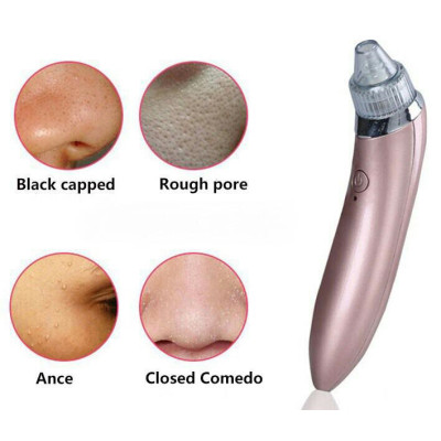 Вакуумный аппарат для чистки пор лица Menqshahayd XN-8030 Pink (kz048-hbr) Вакуумный аппарат для чистки пор лица Menqshahayd XN-8030 Pink (kz048-hbr)